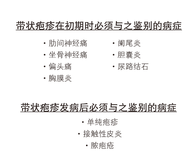 带状疱症症状