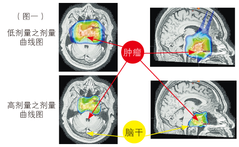 笔尖式扫描