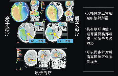 笔尖式扫描