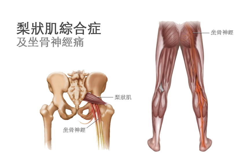 梨状肌