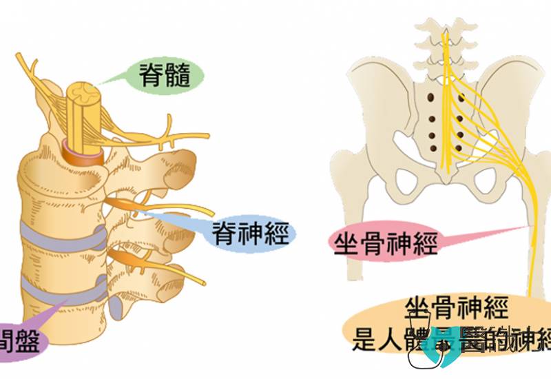 星洲日报，医识力，长庚医院，坐骨神经，坐骨神经痛，脊椎手术